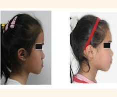 Con gái lúc nhỏ đẹp nhưng càng lớn càng móm, đến bệnh viện bác sĩ nói nguyên nhân khiến gia đình suy sụp