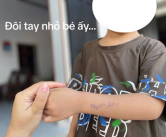 Dòng chữ kém duyên trên cánh tay học sinh mầm non do cô giáo viết khiến gia đình tức giận, mẹ Việt tranh cãi