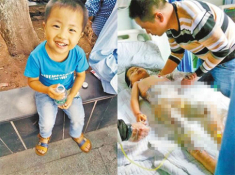 Mẹ lơ là, con 4 tuổi ngã vào nồi sữa nóng