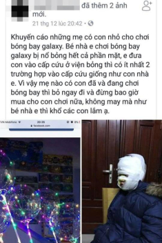 Mẹ phải biết: Bóng bay galaxy “siêu hot” rất nhiều trẻ đòi mua có thể khiến bé bỏng cả mặt