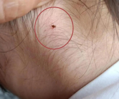 Phát hiện sinh vật lạ cắn vào cổ con gái 4 tuổi, người mẹ vẫn “từ chối” hai lần cứu con và cái kết không ngờ