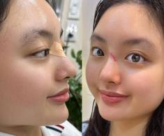 Ái nữ nhà Thúy Hạnh là “bản sao” của mẹ, sở hữu chiếc mũi cực phẩm bị nghi “dao kéo” ở tuổi 16