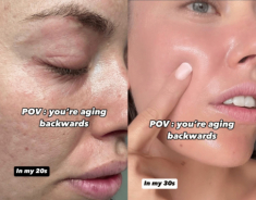 Hai thay đổi giúp U40 tăng collagen cho da