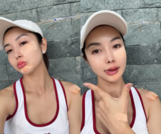 Hoa hậu Jennifer Phạm trầy hết nửa mặt vì ngã khi chơi pickleball, dân mạng bày tỏ “không phải chồng mà nhìn còn xót”