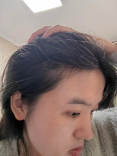 Nhổ tóc không làm giảm đi lượng tóc bạc, chị em áp dụng 4 mẹo sau để tóc đen nhánh và bóng khỏe