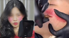 Những trào lưu thẩm mỹ kỳ lạ của giới trẻ, ngay cả bác sĩ “dao kéo” cũng phải hốt hoảng