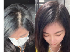 Tóc rụng thưa sắp hói, chị em 40 áp dụng 5 phương pháp đơn giản này để “đảo ngược” tình trạng