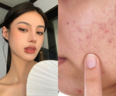 Tránh xa những thói quen ngày Tết nếu không muốn da nhăn nheo và cả năm chăm da hoá “công cốc”