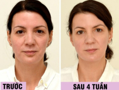 Uống loại nước rẻ tiền này mỗi ngày, người phụ nữ U45 đẹp lên không tưởng chỉ sau 1 tháng, làn da như được “tái sinh” hoàn toàn