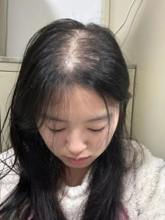 Tóc mọc chậm mãi không dài lại hay rụng nhiều, thử ngay bí quyết giúp tóc dài gấp đôi trong 1 tháng của gái Hàn