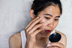 Trải nghiệm soi da AI: Bí quyết phát hiện nám sớm tại thẩm mỹ viện Ngọc Dung