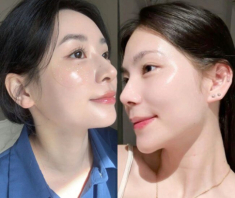 5 loại nước rẻ xịn là “collagen tự nhiên”, giúp da chị em căng bóng, mịn màng như em bé