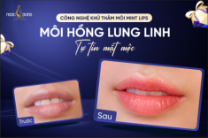 Khử thâm môi Mint Lips có thật sự làm sáng môi chỉ sau 1 buổi không?