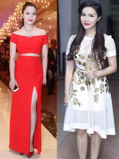 Ngọc Anh: “Tôi bị nghi oan việc độn cằm”