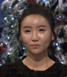 Phẫu thuật 20 lần để giống búp bê Barbie