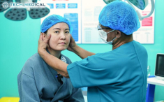 Thắt cơ vi điểm, giải pháp trẻ hóa được nhiều chị em Việt Kiều lựa chọn