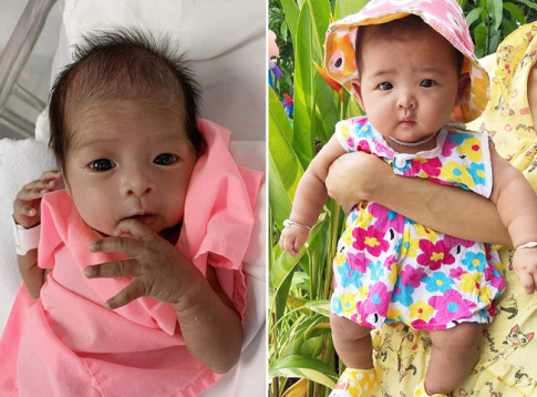 Con sinh thiếu tháng 1,39kg, da nhăn nheo, 6 tháng sau mẹ bật khóc vì may đã không vứt bỏ